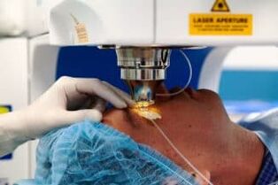 Chirurgie de la vision laser
