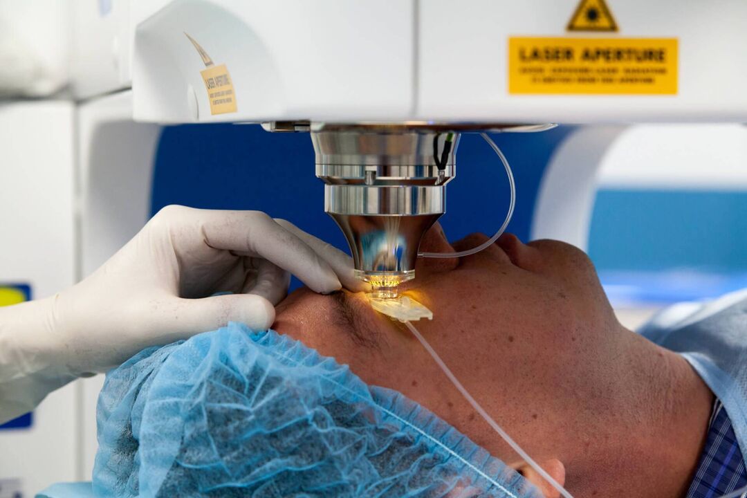 Chirurgie au laser pour restaurer la vision.