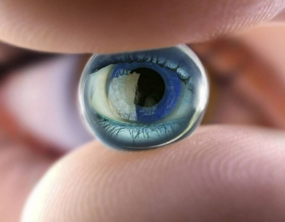 Les lentilles de nuit d'orthokératologie stopperont la progression de la déficience visuelle